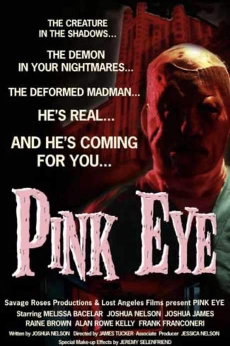 Pink Eye